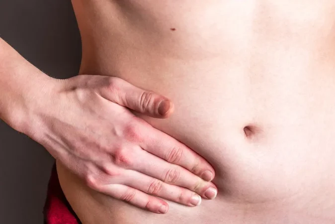 Hernia Abdominal Texcoco